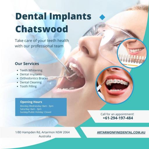 Dental Implants Chatswood jpg