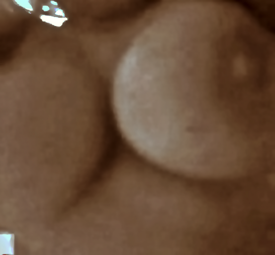 noname49 png
