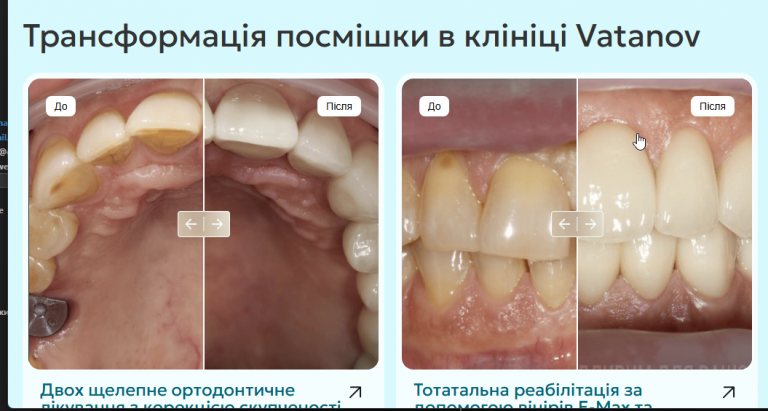 2025 11 04 17 48 34 png