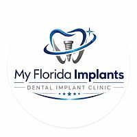 Dental Implants Jupiter jpg