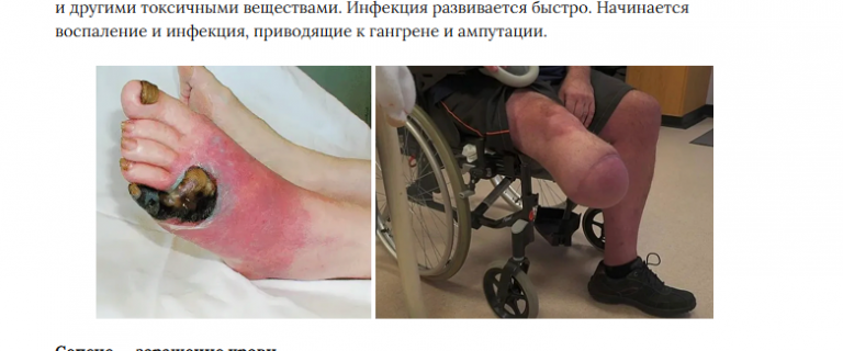 2026 02 27 15 33 49 png