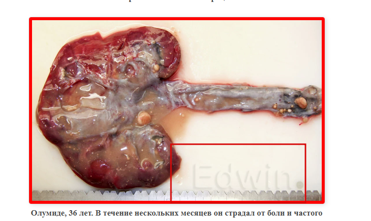 2026 03 03 11 46 57 png