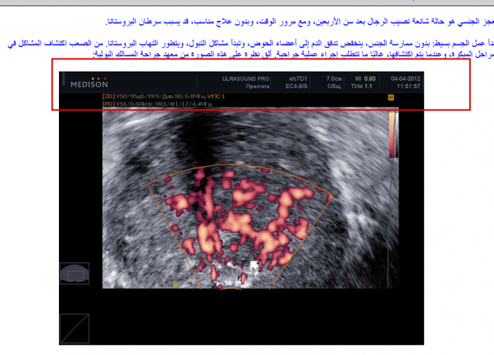 2025 11 26 15 36 46 png