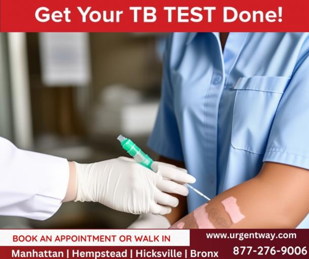 TB skin test near me jpg